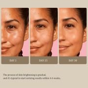 PALFICAB Kojic Acid Turmeric Soap – Dark Spot Remover & Skin Brightening (3 Bars)